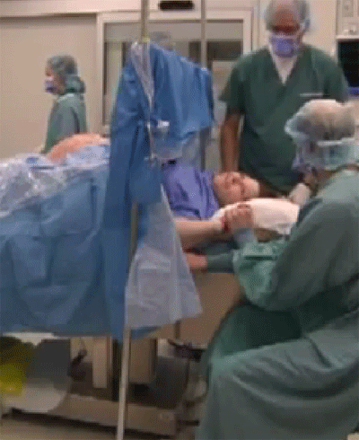 Caesarean Birth (C-section)