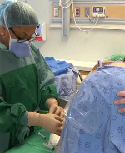 Women getting an epidural