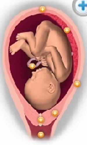 Baby in uterus