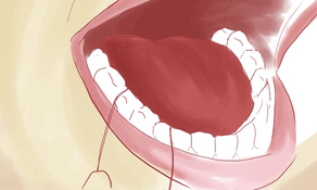 How to floss Flossing teeth