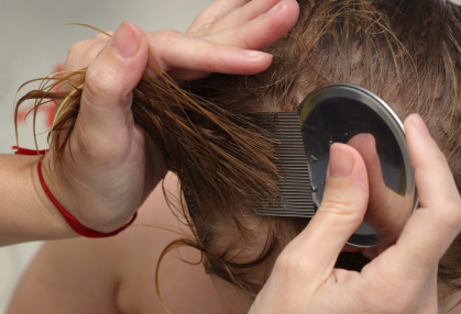 Combing head lice