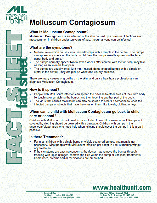 and print the Molluscum Contagiosum Fact Sheet. Molluscum Contagiosum 