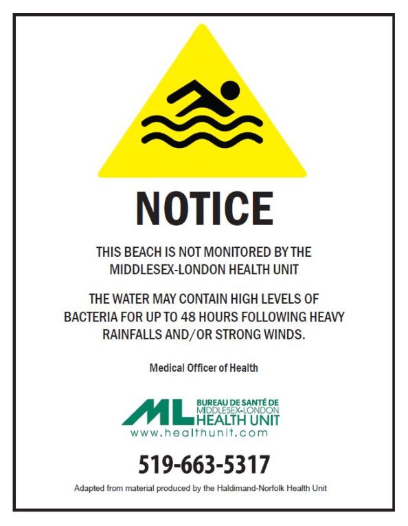 A picture of a sign indicating that the beach is not monitored.