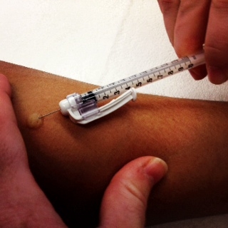 TB Skin test needle