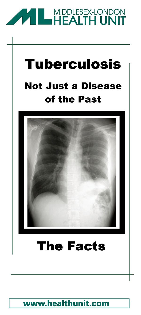 TB Not a Disease of the Past pamphlet