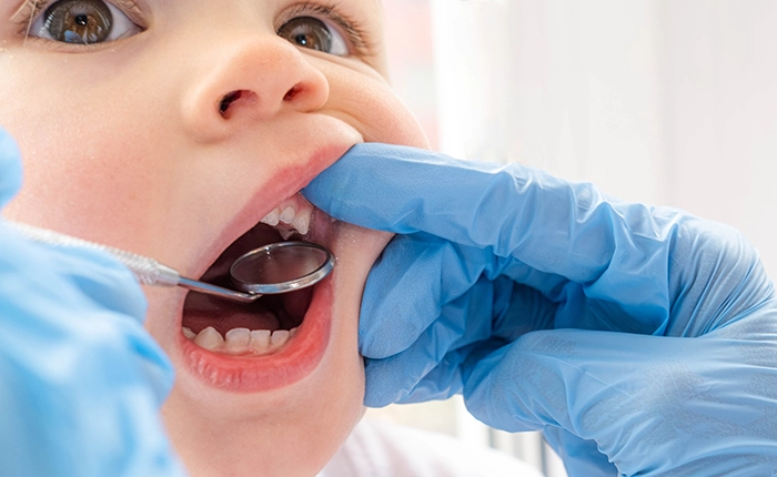 toddler having their teeth checked by healthcare providers